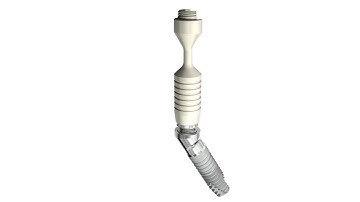 Xive SmartFix® - the concept | Dentsply Sirona