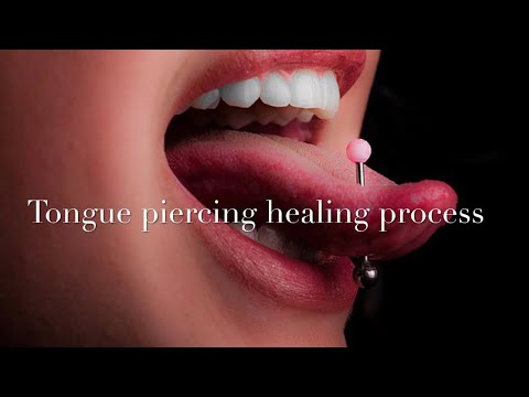 舌ピアスの治癒過程