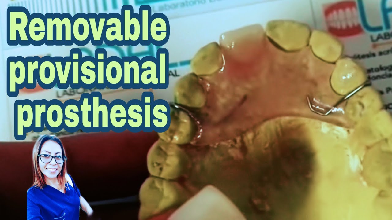 REMOVABLE PROVISIONAL PROSTHESIS. STEP BY STEP YouTube