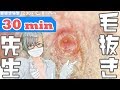 083 [200x Zoom] 30 minutes beard video  Dr. tweezers 毛抜き先生の角栓や毛根