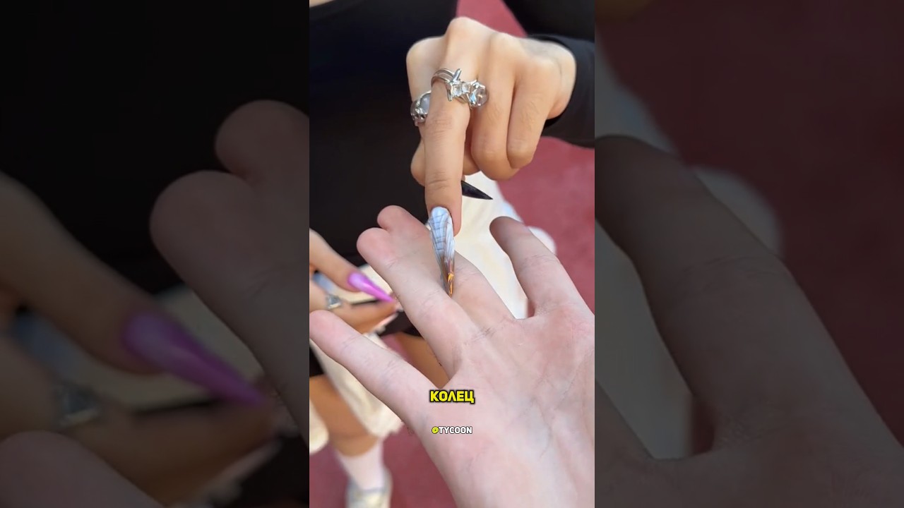 Парень со сросшимися пальцами.