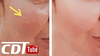 7 astuces naturels pour resserrer les pores dilatés et avoir une peau radieuse | CDT NEWS
