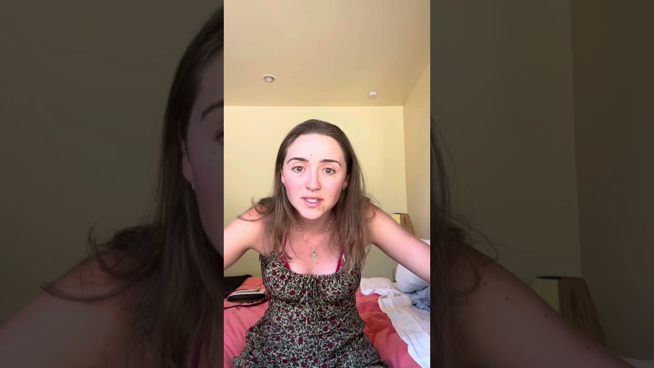 My Hair loss story part 1/2 