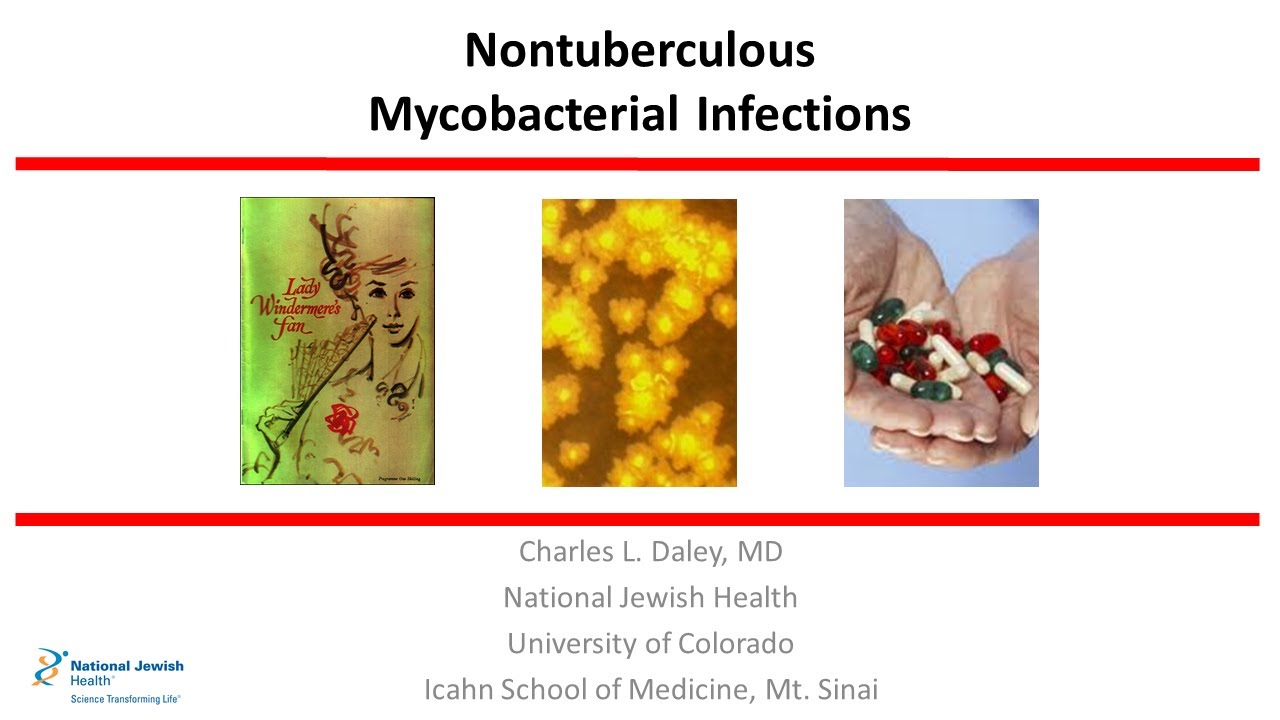 Nontuberculous Mycobacterial Infections (2019) - YouTube