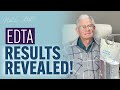 EDTA Chelation Therapy Benefits for Heart Health | Real Patient Story with Dr. Nhi Le