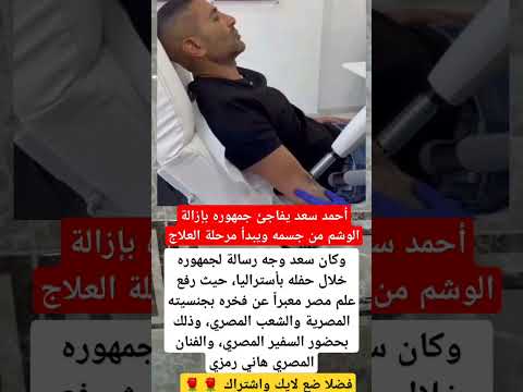 أحمد سعد يفاجئ جمهوره بإزالة الوشم من جسمه ويبدأ مرحلة العلاج فنانين اخبار اكسبلور