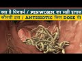 Chunna katne ka ilaj ii pinworm treatment li pinworm ki dawa ii chunne ka ilaj ii thydoc