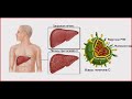 Современная противовирусная терапия гепатита C