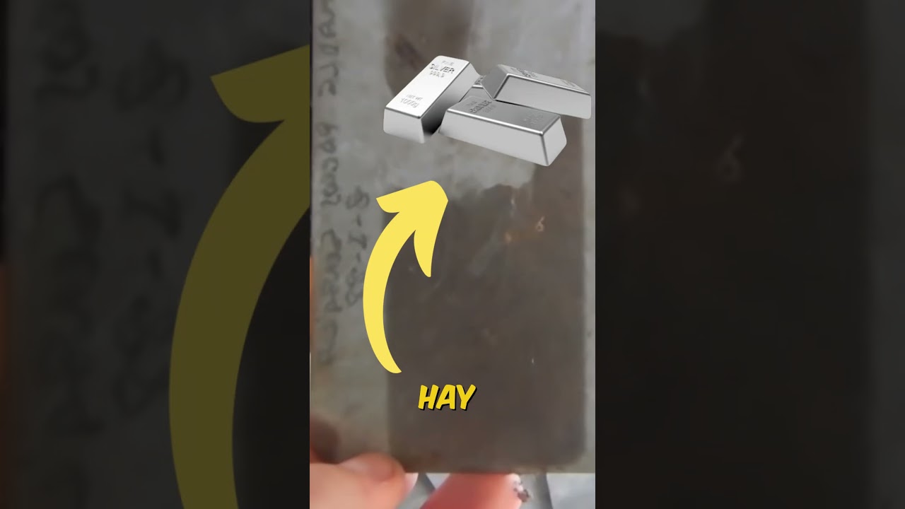 ¿Vale la pena sacar plata de las radiografías? Mira cuánto ganó