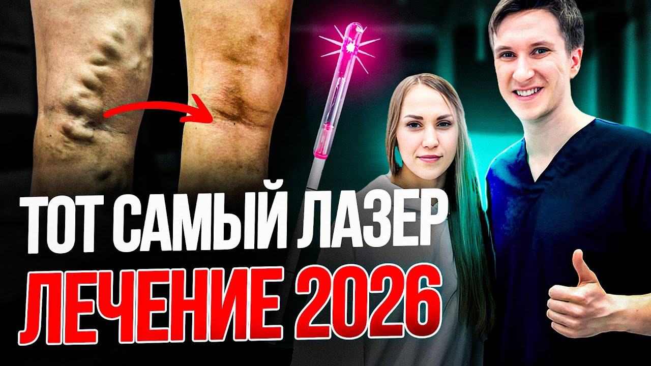 30 МИНУТ - И НИКАКОГО ВАРИКОЗА! Вся ПРАВДА о лазерном лечении вен!