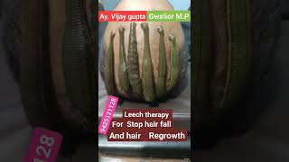 Leech therapy for hair problems screenshot 3