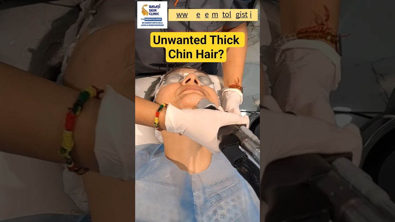 Motus Ax Chin laser hair Reduction Balaji Skin Clinic #skincaredelhi #balajiskincare #skinlaser