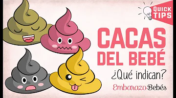 ¿Cuándo debo preocuparme por el color de las cacas del bebé?