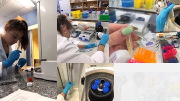 Creating dissolvable nanoparticle-doped-microneedle technology for a new treatment of skin cancer