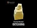 Dental model ditching  qualident dental lab