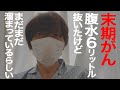 【緊急入院12日目】寝ていたらお腹に違和感が…見たら○○○がパンパンに！【人工肛門から大量出血】【肝臓がん】【ステージⅣ 】【余命宣告