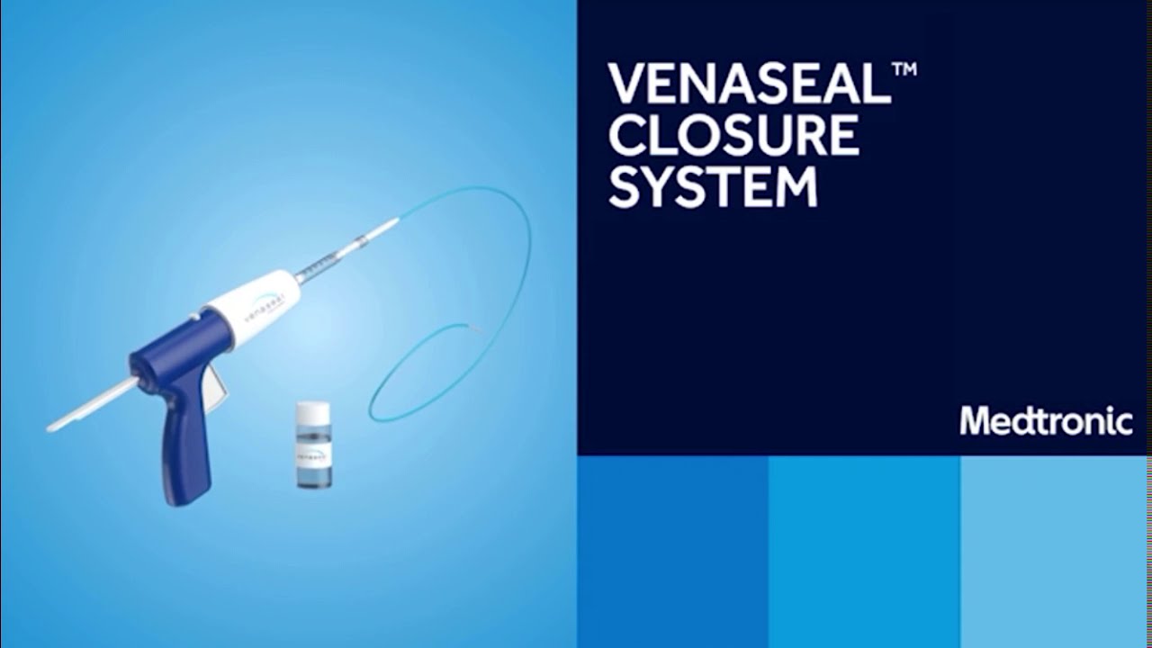 VenaSeal Medical Superglue Treatment for Varicose Veins | The Vein Institute.