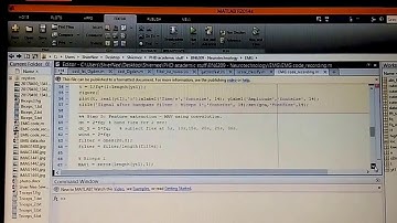 EMG signal processing steps