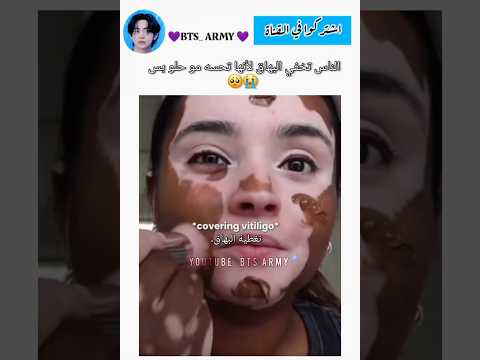الناس تحاول تخفيه بس