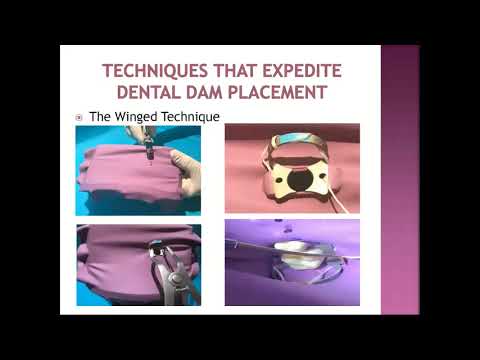 Video The Benefits of Using Dental Dam - youtube