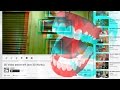 3D Video Extreme Teeth!!!