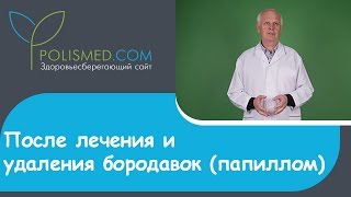 После лечения и удаления бородавок (папиллом)