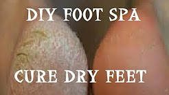 Affordable DIY Foot Spa | Cure Dry Damaged Feet