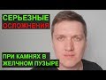 ОСЛОЖНЕНИЯ! Что будет, если вовремя не удалить желчный пузырь с камнями?