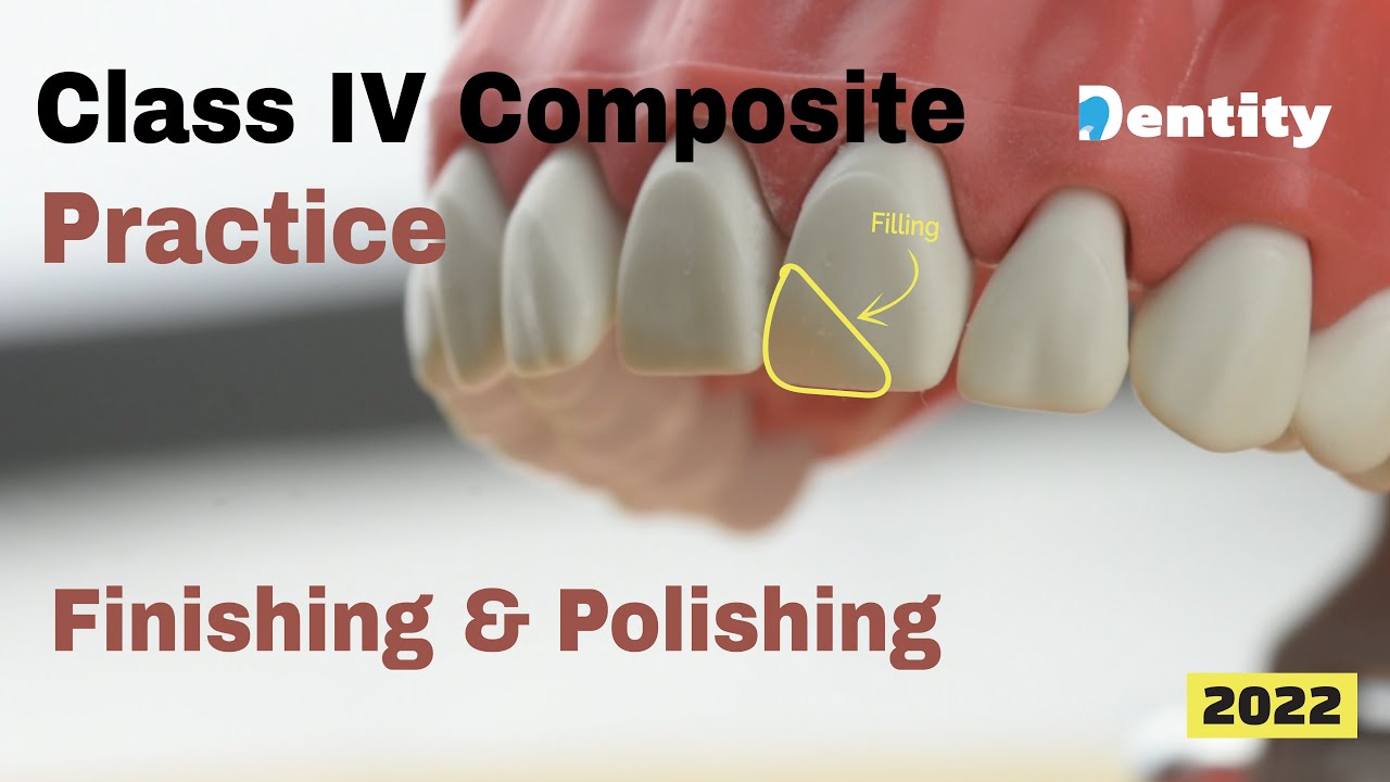Class IV Finishing & Polishing تلميع وتنعيم حشوات الأسنان الأمامية