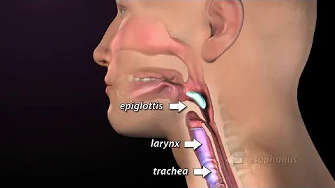 ¿Por qué necesita una prueba de deglución?