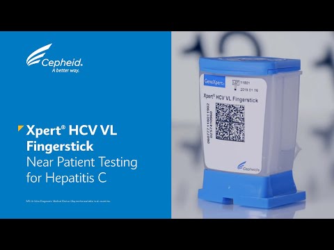 Xpert HCV VL Fingerstick - Near Patient Testing for Hepatitis C