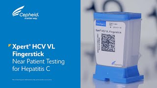 Xpert HCV VL Fingerstick - Near Patient Testing For Hepatitis C Xpert HCV VL Fingerstick - Near Patient Testing For Hepatitis C