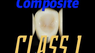 layered class I composite resin! NO FINISHING NEEDED!? part 2 4K video