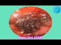 ASMR Ear Cleaning | Guaranteed Tingles and Instant Relaxation