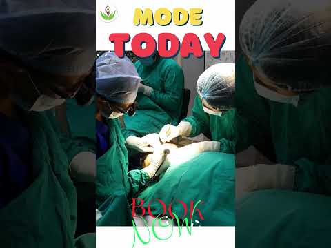 Beard Transplant for Fuller Facial Hair Morning Mode Today Care Well Medical Centre