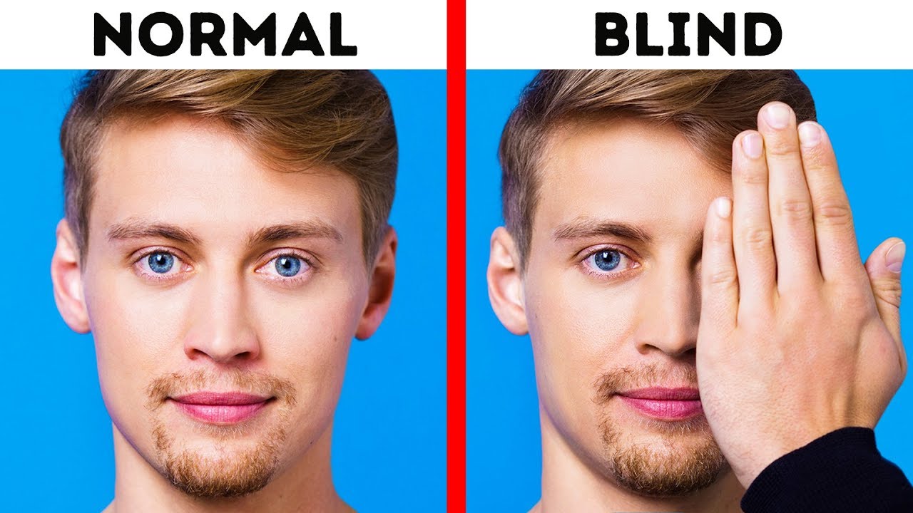 blind person blue eyes