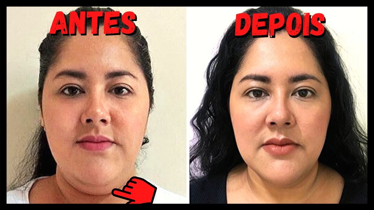 Como Emagrecer o Rosto - Exercícios Incríveis Para Afinar o Rosto e ...
