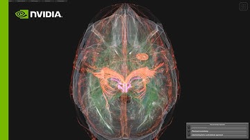 Uniting Doctors with Data Scientists to Accelerate AI in Medicine