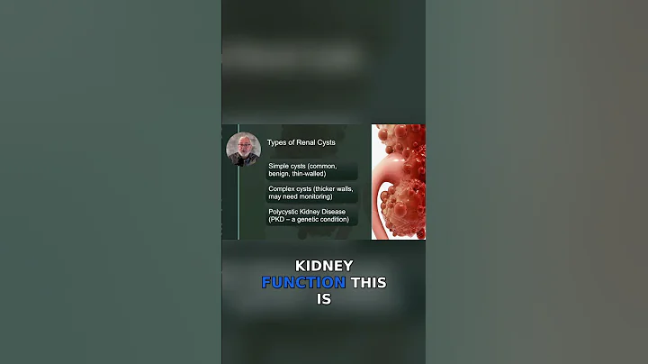 The Seriousness of Polycystic Kidney Disease Explained