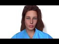 Animated video demonstrating hairline lowering surgery