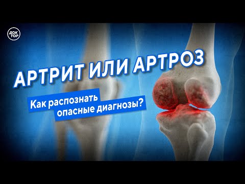 Артрит или артроз? Как распознать данные диагнозы?