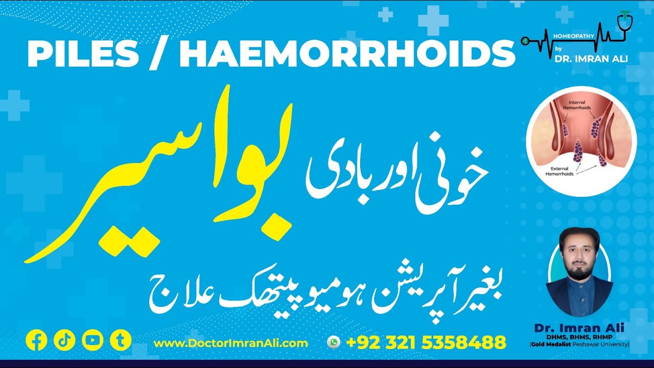 Piles Hemorrhoids Homeopathic Treatment Without Operation With Best Medicines | Dr Imran Ali