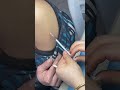 Intramuscular Injection Technique Explained | Safe IM Injection Step-by-Step | Nurse Guide Class 01