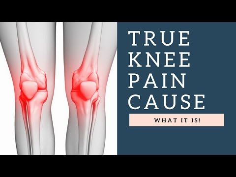 Your TRUE Knee