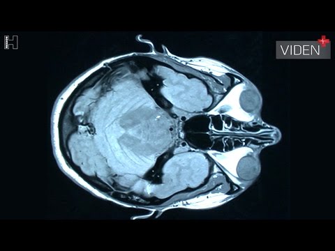 Video: Gastrisk Tömande Skanning - Definition Och Patientutbildning