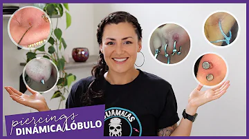 ¿Es normal tener un bulto en el piercing del lóbulo?