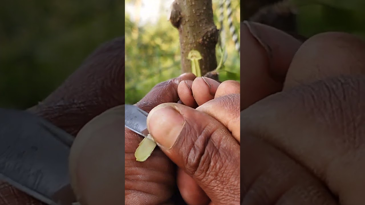 Revolutionary Skin Grafting Technique Revealed!