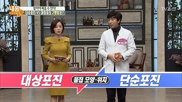 착각하기 쉬운 단순포진vs대상포진 구분하는 방법 [내 몸 사용설명서] 194회 20180302