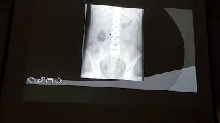 Urinary tract imaging 1/3