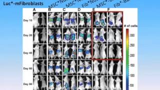 Understanding Mesenchymal Stem Cell and Considerations for Treatment by Mark F. Pittenger Ph.D